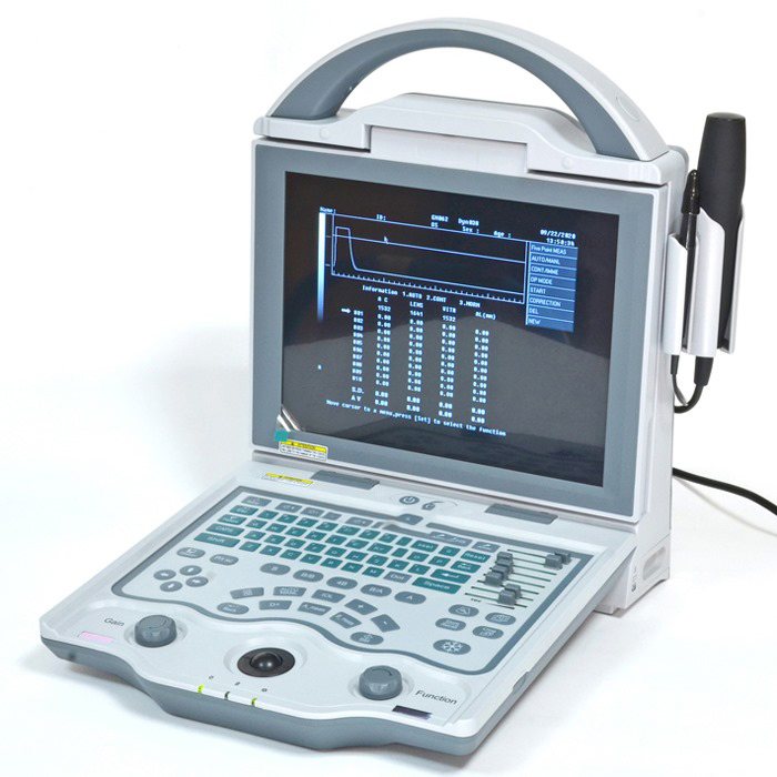 echographe_A_B_scan_ODU5_Abidjan_Vision_Pharma-CI_materiel_medical