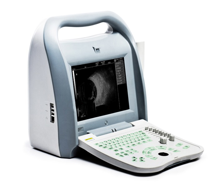 echographe_A_B_scan_ODU8_Abidjan_Vision_Pharma-CI_materiel_medical3
